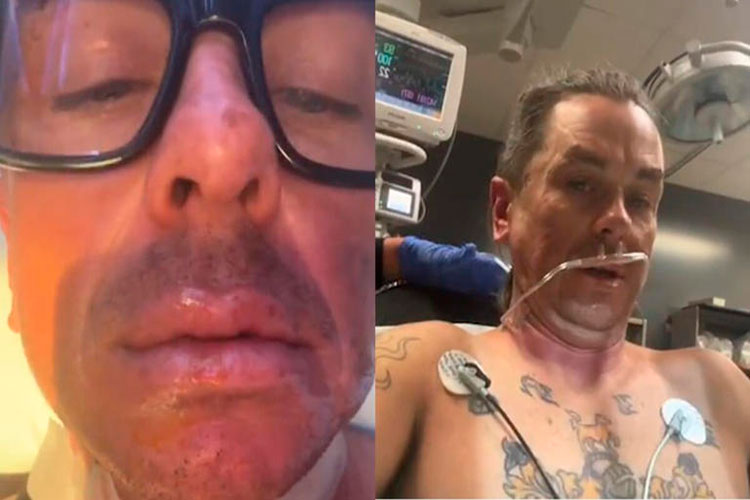 Sid Wilson (Slipknot) sufre un accidente doméstico